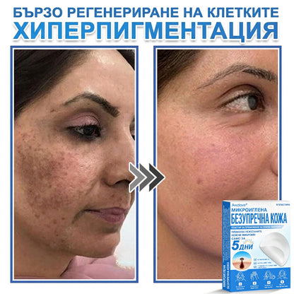Awzlove® 2-в-1 пластир с микроигли и хидроколоид | Премахва повдигнати бенки, акне, плоски брадавици и кожни образувания | Подобрява бръчки, белези и несъвършенства | Невидими звездовидни пластири за лице и тяло |🐒🐶1