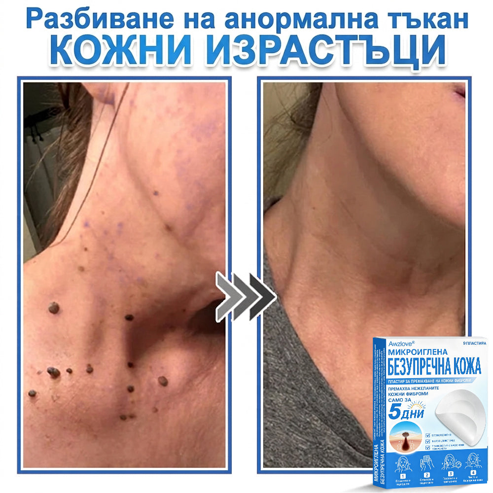 Awzlove® 2-в-1 пластир с микроигли и хидроколоид | Премахва повдигнати бенки, акне, плоски брадавици и кожни образувания | Подобрява бръчки, белези и несъвършенства | Невидими звездовидни пластири за лице и тяло |🐒🐶1