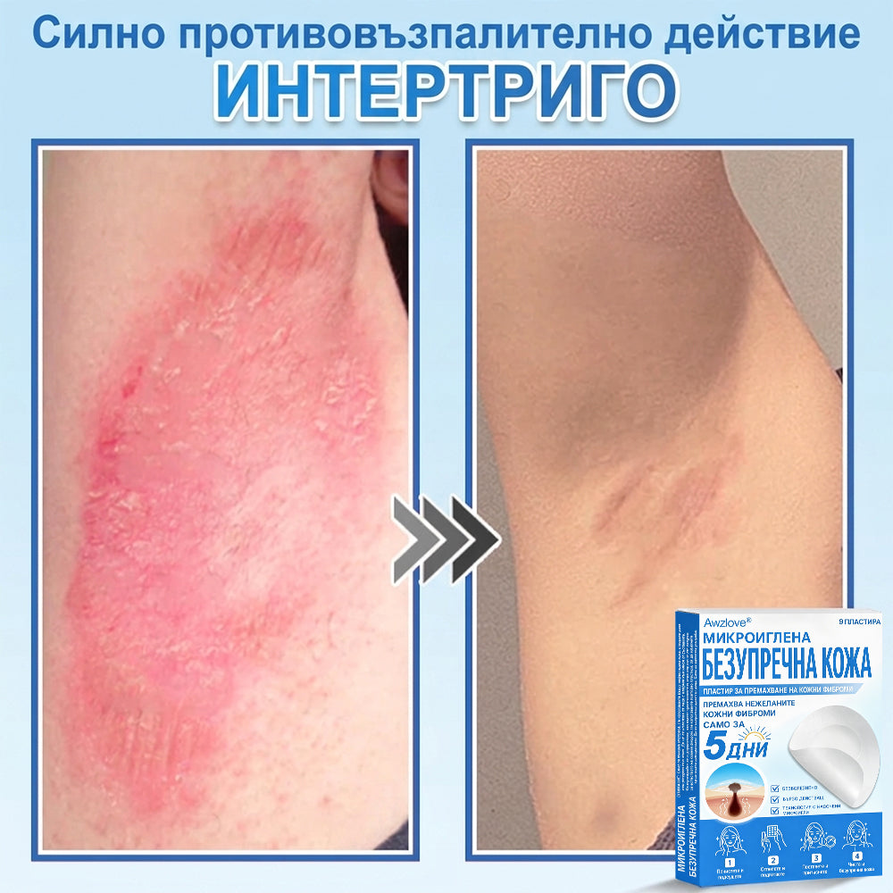 Awzlove® 2-в-1 пластир с микроигли и хидроколоид | Премахва повдигнати бенки, акне, плоски брадавици и кожни образувания | Подобрява бръчки, белези и несъвършенства | Невидими звездовидни пластири за лице и тяло |🐒🐶1