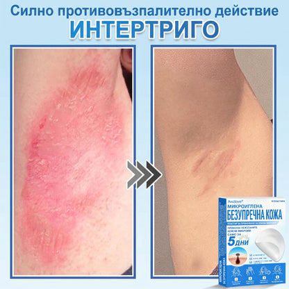 Awzlove® 2-в-1 пластир с микроигли и хидроколоид | Премахва повдигнати бенки, акне, плоски брадавици и кожни образувания | Подобрява бръчки, белези и несъвършенства | Невидими звездовидни пластири за лице и тяло |🐒🐶1