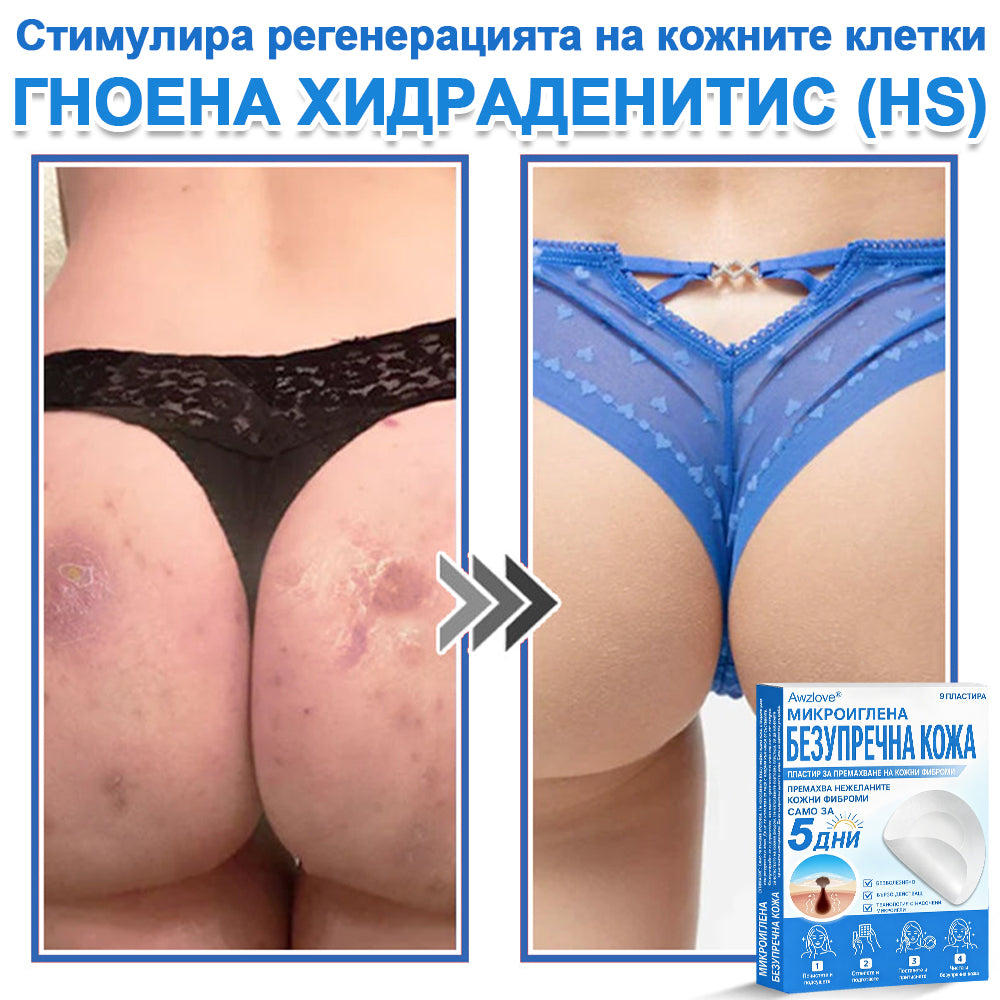 Awzlove® 2-в-1 пластир с микроигли и хидроколоид | Премахва повдигнати бенки, акне, плоски брадавици и кожни образувания | Подобрява бръчки, белези и несъвършенства | Невидими звездовидни пластири за лице и тяло |🐒🐶1