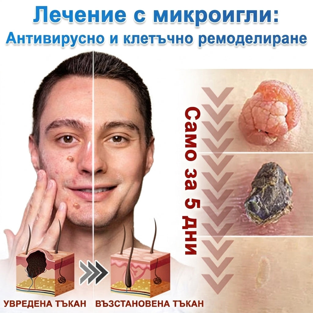 Awzlove® 2-в-1 пластир с микроигли и хидроколоид | Премахва повдигнати бенки, акне, плоски брадавици и кожни образувания | Подобрява бръчки, белези и несъвършенства | Невидими звездовидни пластири за лице и тяло |🐒🐶1