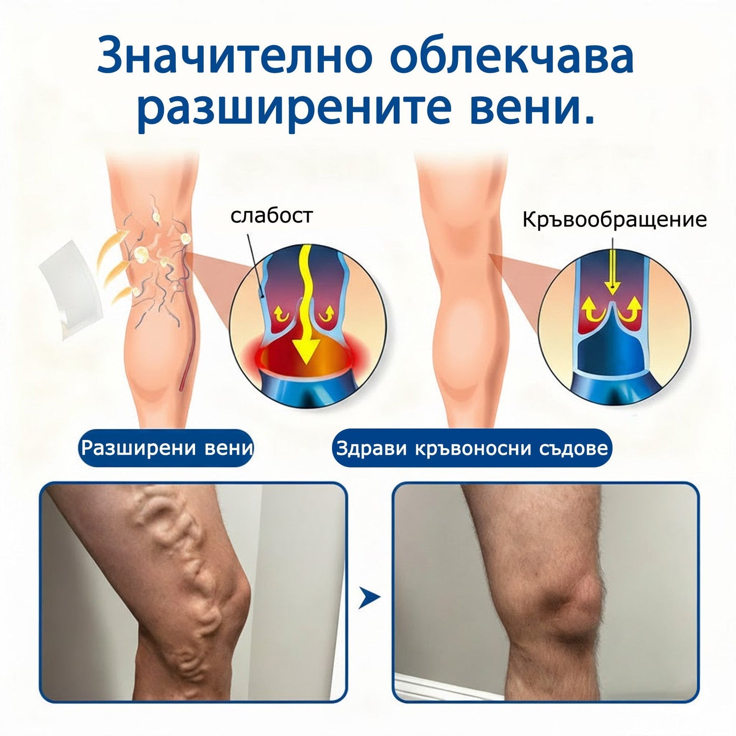 🧙‍♂️🎷  H𝐞a𝐥r𝐢z𝐞® VeinEase Микроиглен Пластир ⚡ Мигновено Облекчение, Дълготрайни Резултати🏃‍♂️‍➡️🏃‍♂️‍➡️3