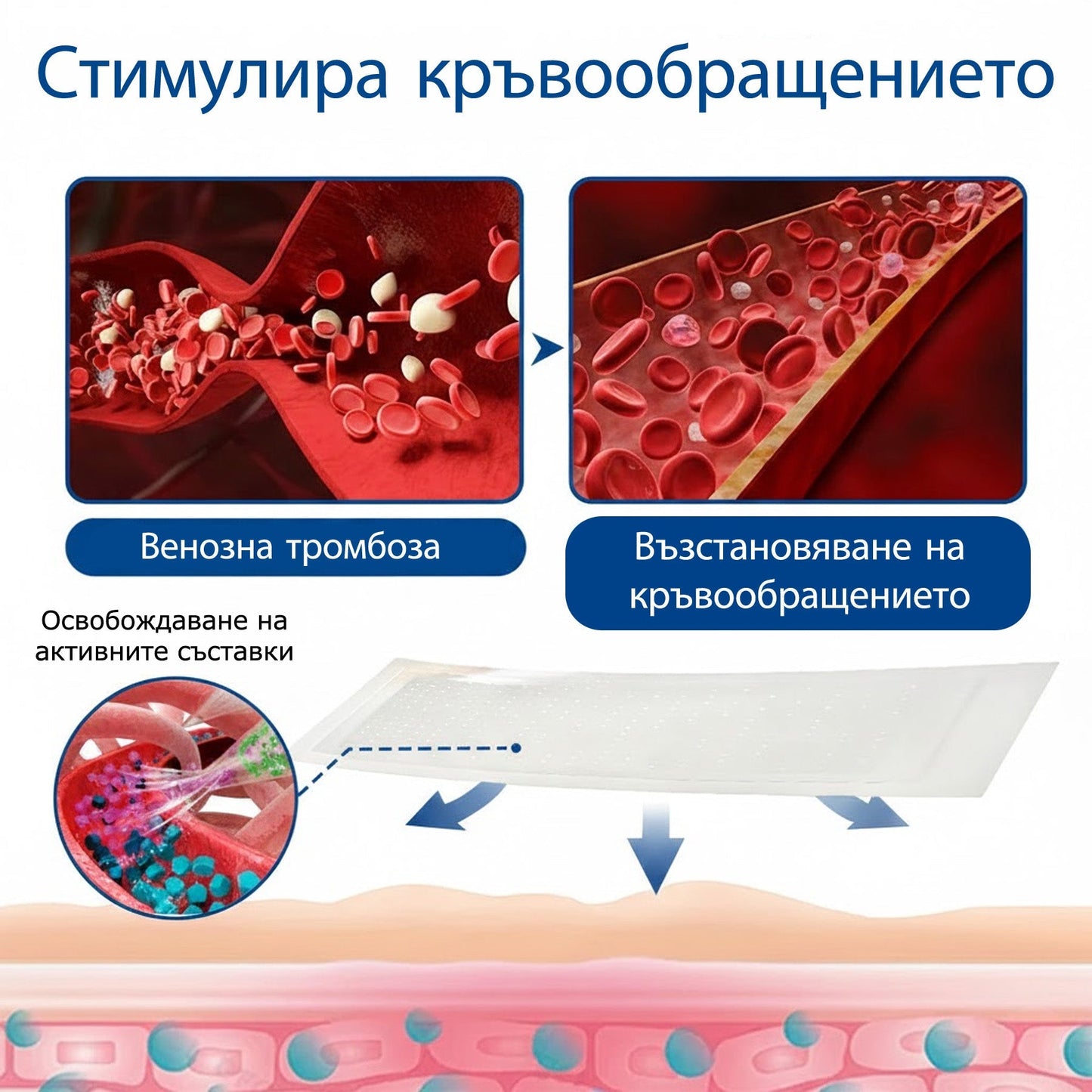 🧙‍♂️🎷  H𝐞a𝐥r𝐢z𝐞® VeinEase Микроиглен Пластир ⚡ Мигновено Облекчение, Дълготрайни Резултати🏃‍♂️‍➡️🏃‍♂️‍➡️3