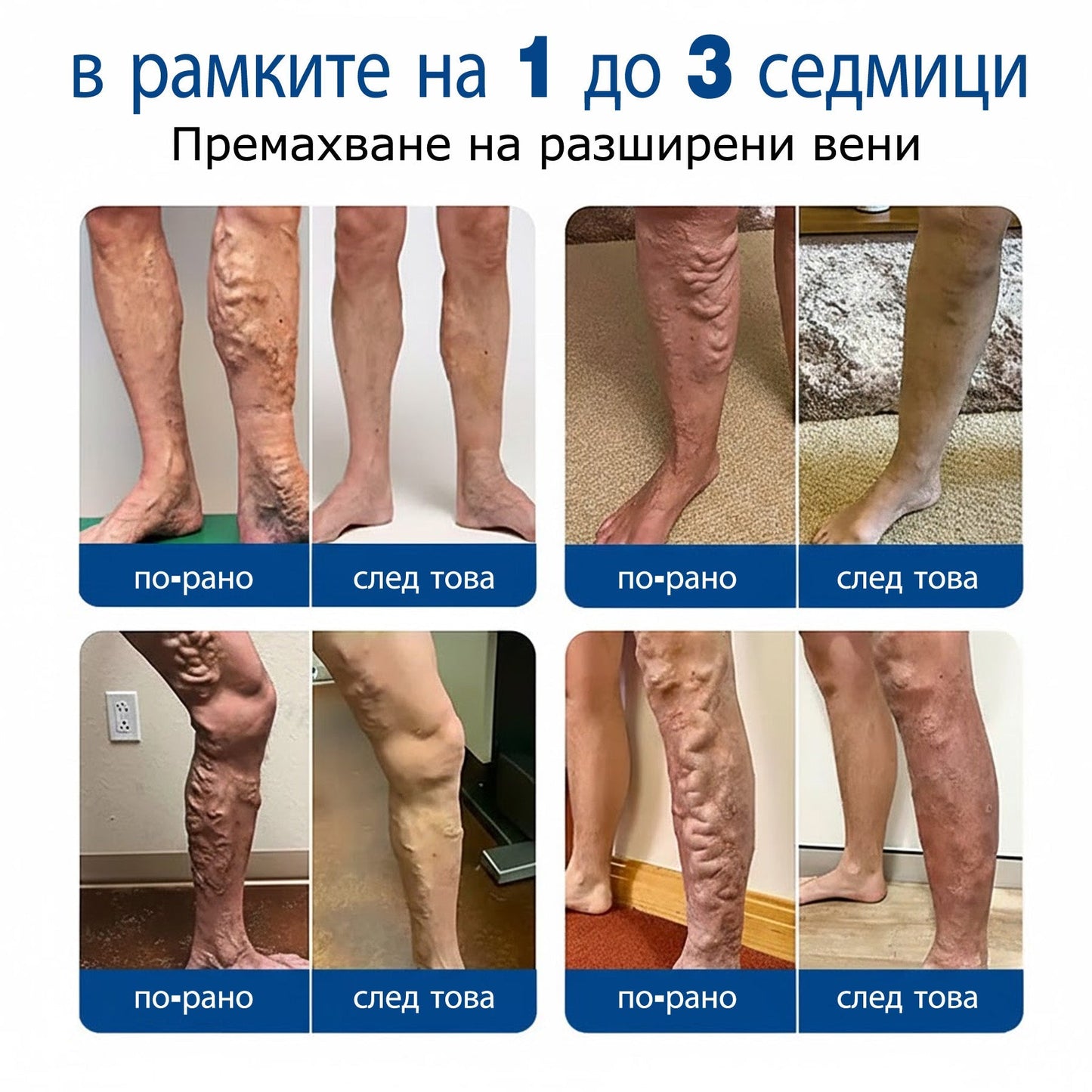 🧙‍♂️🎷  H𝐞a𝐥r𝐢z𝐞® VeinEase Микроиглен Пластир ⚡ Мигновено Облекчение, Дълготрайни Резултати🏃‍♂️‍➡️🏃‍♂️‍➡️3