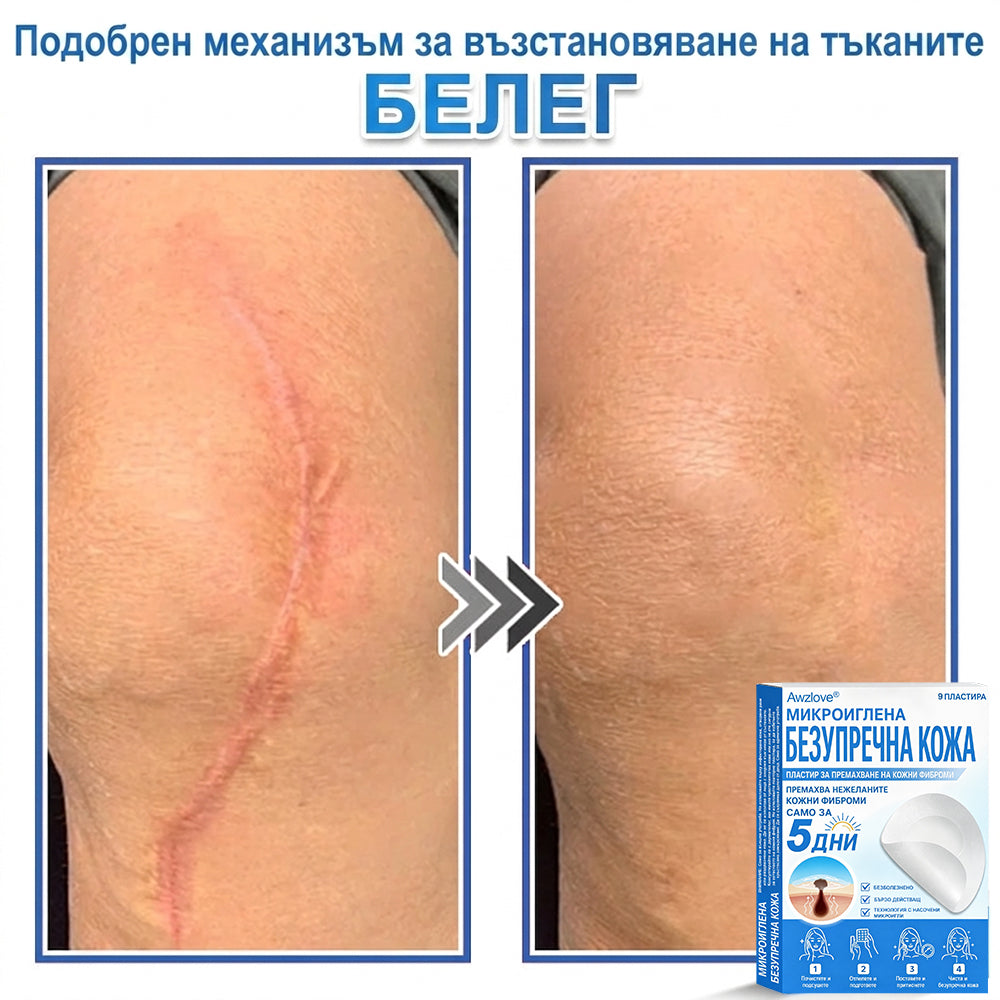 Awzlove® 2-в-1 пластир с микроигли и хидроколоид | Премахва повдигнати бенки, акне, плоски брадавици и кожни образувания | Подобрява бръчки, белези и несъвършенства | Невидими звездовидни пластири за лице и тяло |🐒🐶1