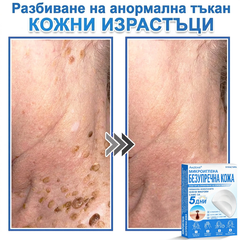 Awzlove® 2-в-1 пластир с микроигли и хидроколоид | Премахва повдигнати бенки, акне, плоски брадавици и кожни образувания | Подобрява бръчки, белези и несъвършенства | Невидими звездовидни пластири за лице и тяло |🐒🐶1